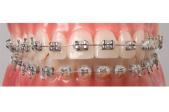 Brackets Agile MBT .022 Sup. (10 u.) 23g